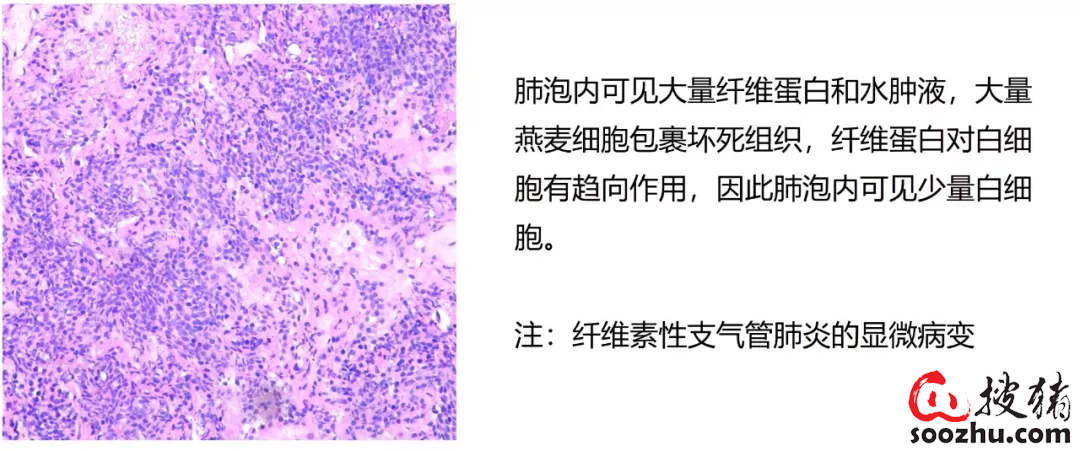 52fade0670177412a432c8b43a39f06dac6cba0d.png